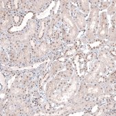 Anti-MED20 antibody produced in rabbit Prestige Antibodies® Powered by Atlas Antibodies, affinity isolated antibody, buffered aqueous glycerol solution