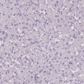 Anti-MAPT antibody produced in rabbit Prestige Antibodies® Powered by Atlas Antibodies, affinity isolated antibody, buffered aqueous glycerol solution