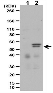 Anti-phospho-MLKL (Ser358) Antibody Set from rabbit, purified by affinity chromatography