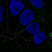 Anti-CTNNA1 antibody produced in rabbit Prestige Antibodies® Powered by Atlas Antibodies, affinity isolated antibody, buffered aqueous glycerol solution