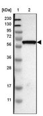 Anti-GDF5 antibody produced in rabbit Prestige Antibodies® Powered by Atlas Antibodies, affinity isolated antibody, buffered aqueous glycerol solution