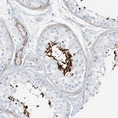 Anti-SMCP antibody produced in rabbit Prestige Antibodies® Powered by Atlas Antibodies, affinity isolated antibody, buffered aqueous glycerol solution