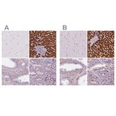 Anti-CES1 antibody produced in rabbit Prestige Antibodies® Powered by Atlas Antibodies, affinity isolated antibody, buffered aqueous glycerol solution