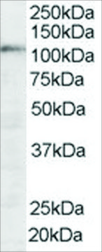 Anti-SART1 antibody produced in goat affinity isolated antibody, buffered aqueous solution