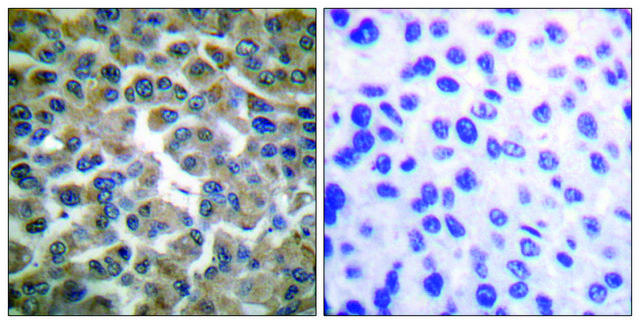 Anti-I&#954;B-&#949; antibody produced in rabbit affinity isolated antibody