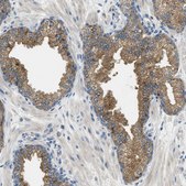 Anti-RIPK2 antibody produced in rabbit Prestige Antibodies® Powered by Atlas Antibodies, affinity isolated antibody, buffered aqueous glycerol solution