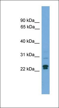 Anti-TP53INP2 antibody produced in rabbit affinity isolated antibody