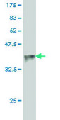 Monoclonal Anti-SPSB2 antibody produced in mouse clone 1E6, purified immunoglobulin, buffered aqueous solution