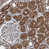 Anti-TCTN1 antibody produced in rabbit Prestige Antibodies® Powered by Atlas Antibodies, affinity isolated antibody, buffered aqueous glycerol solution