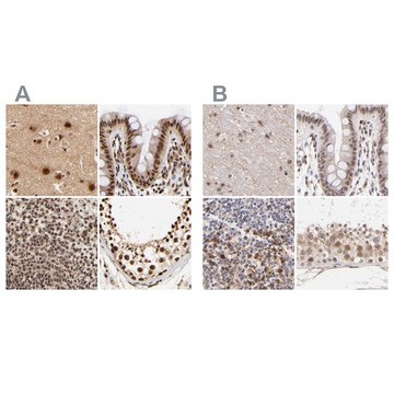 Anti-MED12 antibody produced in rabbit Ab1, Prestige Antibodies&#174; Powered by Atlas Antibodies, affinity isolated antibody, buffered aqueous glycerol solution