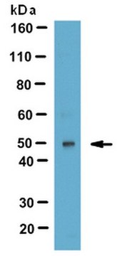 Anti-LYAR Antibody (Ly1 Antibody reactive clone) from rabbit, purified by affinity chromatography