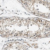 Anti-ZDHHC23 antibody produced in rabbit Prestige Antibodies® Powered by Atlas Antibodies, affinity isolated antibody, buffered aqueous glycerol solution