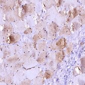 Anti-GAPDH antibody produced in rabbit Prestige Antibodies&#174; Powered by Atlas Antibodies, affinity isolated antibody, buffered aqueous glycerol solution