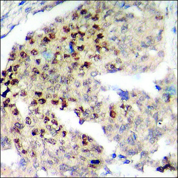 Anti-phospho-Akt1 (pThr450) antibody produced in rabbit affinity isolated antibody