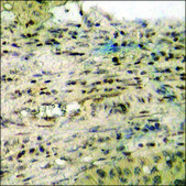 Anti-phospho-HRS (pTyr334) antibody produced in rabbit affinity isolated antibody