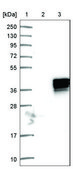 Anti-TBX20 antibody produced in rabbit Prestige Antibodies® Powered by Atlas Antibodies, affinity isolated antibody, buffered aqueous glycerol solution