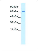 Anti-TRIM17 (AB1) antibody produced in rabbit affinity isolated antibody