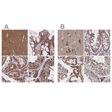 Anti-NFS1 antibody produced in rabbit Prestige Antibodies&#174; Powered by Atlas Antibodies, affinity isolated antibody, buffered aqueous glycerol solution