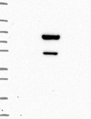 Anti-ZBTB9 antibody produced in rabbit Prestige Antibodies® Powered by Atlas Antibodies, affinity isolated antibody, buffered aqueous glycerol solution