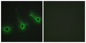 Anti-Collagen V α3 antibody produced in rabbit affinity isolated antibody