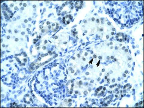 Anti-PAX2 IgG fraction of antiserum