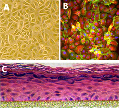 Human Epidermal Keratinocytes: HEK, adult