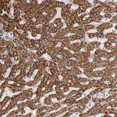 Anti-ECHDC2 antibody produced in rabbit Prestige Antibodies® Powered by Atlas Antibodies, affinity isolated antibody, buffered aqueous glycerol solution, Ab1