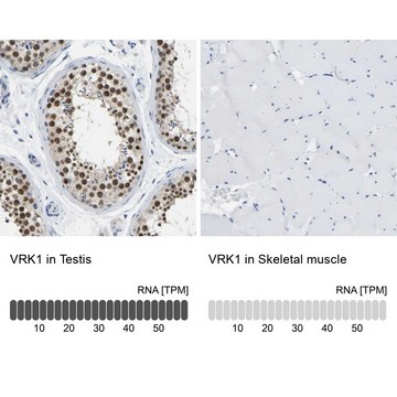 Anti-VRK1 antibody produced in rabbit Prestige Antibodies&#174; Powered by Atlas Antibodies, affinity isolated antibody, buffered aqueous glycerol solution