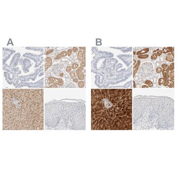 Anti-RIDA antibody produced in rabbit Prestige Antibodies&#174; Powered by Atlas Antibodies, affinity isolated antibody, buffered aqueous glycerol solution, Ab2