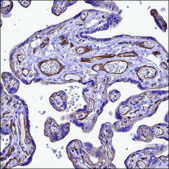 Anti-FLT1 antibody produced in rabbit Prestige Antibodies® Powered by Atlas Antibodies, affinity isolated antibody, buffered aqueous glycerol solution, Ab1