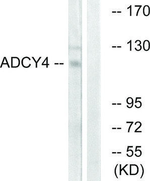 Anti-ADCY4 antibody produced in rabbit affinity isolated antibody