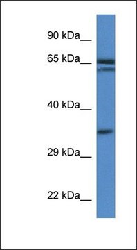 Anti-TERF2IP antibody produced in rabbit affinity isolated antibody