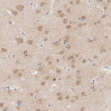 Anti-MPP2 antibody produced in rabbit Prestige Antibodies&#174; Powered by Atlas Antibodies, affinity isolated antibody, buffered aqueous glycerol solution