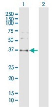 Anti-SPARC antibody produced in rabbit purified immunoglobulin, buffered aqueous solution