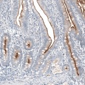Anti-TMPRSS2 antibody produced in mouse Prestige Antibodies® Powered by Atlas Antibodies, clone CL12512, purified by using Protein A, buffered aqueous glycerol solution