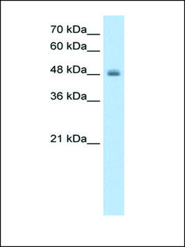 Anti-RNF128 antibody produced in rabbit IgG fraction of antiserum