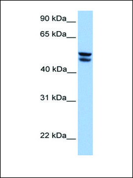 Anti-OXCT1 (AB2) antibody produced in rabbit affinity isolated antibody