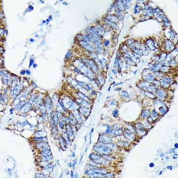 Anti-TNFAIP3 antibody produced in rabbit