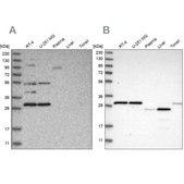Anti-SCO1 antibody produced in rabbit Prestige Antibodies® Powered by Atlas Antibodies, affinity isolated antibody, buffered aqueous glycerol solution, Ab1