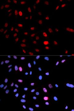 Anti-Phospho-SMC1A-S957 antibody produced in rabbit