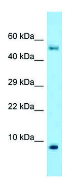 Anti-S100A10 antibody produced in rabbit affinity isolated antibody