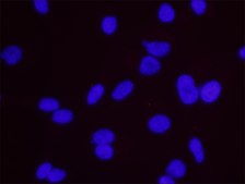 BRCA1 and Estrogen Receptor Alpha PLA® Antibody Kit Powered by Bethyl Laboratories, Inc.