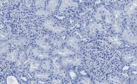 Anti-CARM1 Antibody, clone 2H11 ZooMAb® Rabbit Monoclonal recombinant, expressed in HEK 293 cells