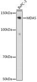 Anti-MDA5 Antibody, clone 2N8Z5, Rabbit Monoclonal