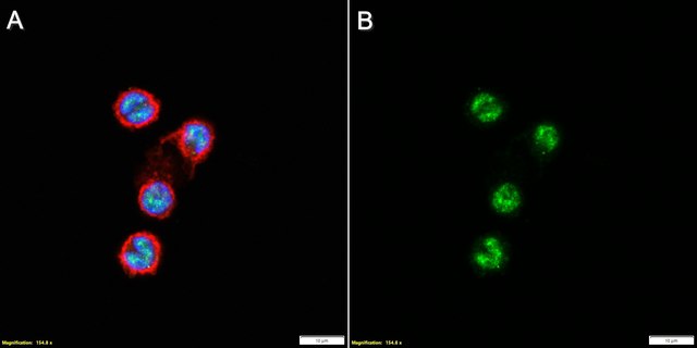 Anti-TBX21 Antibody, clone 1B21 ZooMAb&#174; Rabbit Monoclonal recombinant, expressed in HEK 293 cells