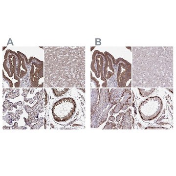 Anti-FMR1 antibody produced in rabbit Prestige Antibodies&#174; Powered by Atlas Antibodies, affinity isolated antibody, buffered aqueous glycerol solution