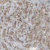 Monoclonal Anti-CDK2 antibody produced in mouse Prestige Antibodies® Powered by Atlas Antibodies, clone CL7990, purified immunoglobulin, buffered aqueous glycerol solution
