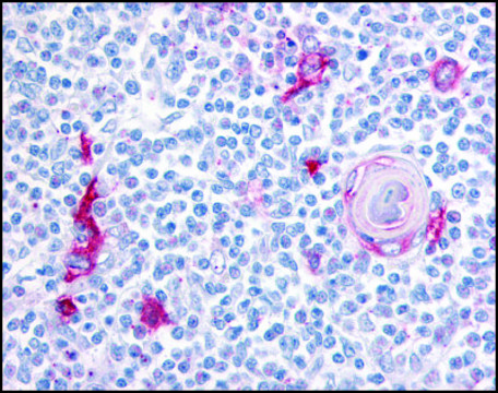 Anti-ITGA4 (AB2) antibody produced in rabbit affinity isolated antibody, buffered aqueous solution