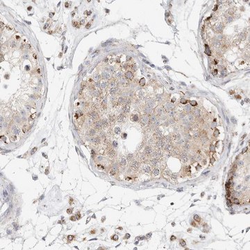 Anti-SLC25A26 antibody produced in rabbit Prestige Antibodies&#174; Powered by Atlas Antibodies, affinity isolated antibody, buffered aqueous glycerol solution