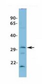 Anti-VDAC3 affinity isolated antibody
